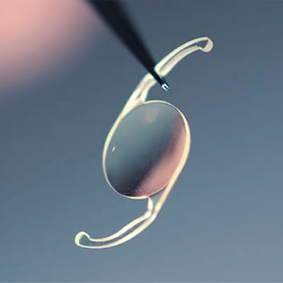 Lentes Intraoculares